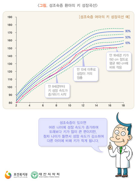 성조숙증 환아의 키 성장곡선