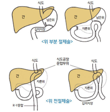 외과수술